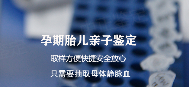 在沈阳怀孕几个月要如何办理孕期亲子鉴定,沈阳做孕期亲子鉴定准不准 在沈阳怀孕几个月要如何办理孕期亲子鉴定,沈阳做孕期亲子鉴定准不准