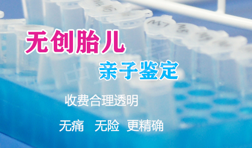 沈阳怀孕了如何做DNA亲子鉴定最简单方便,沈阳孕期亲子鉴定要多少钱 沈阳怀孕了如何做DNA亲子鉴定最简单方便,沈阳孕期亲子鉴定要多少钱